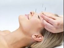 Acupuncture Eval and Treatment