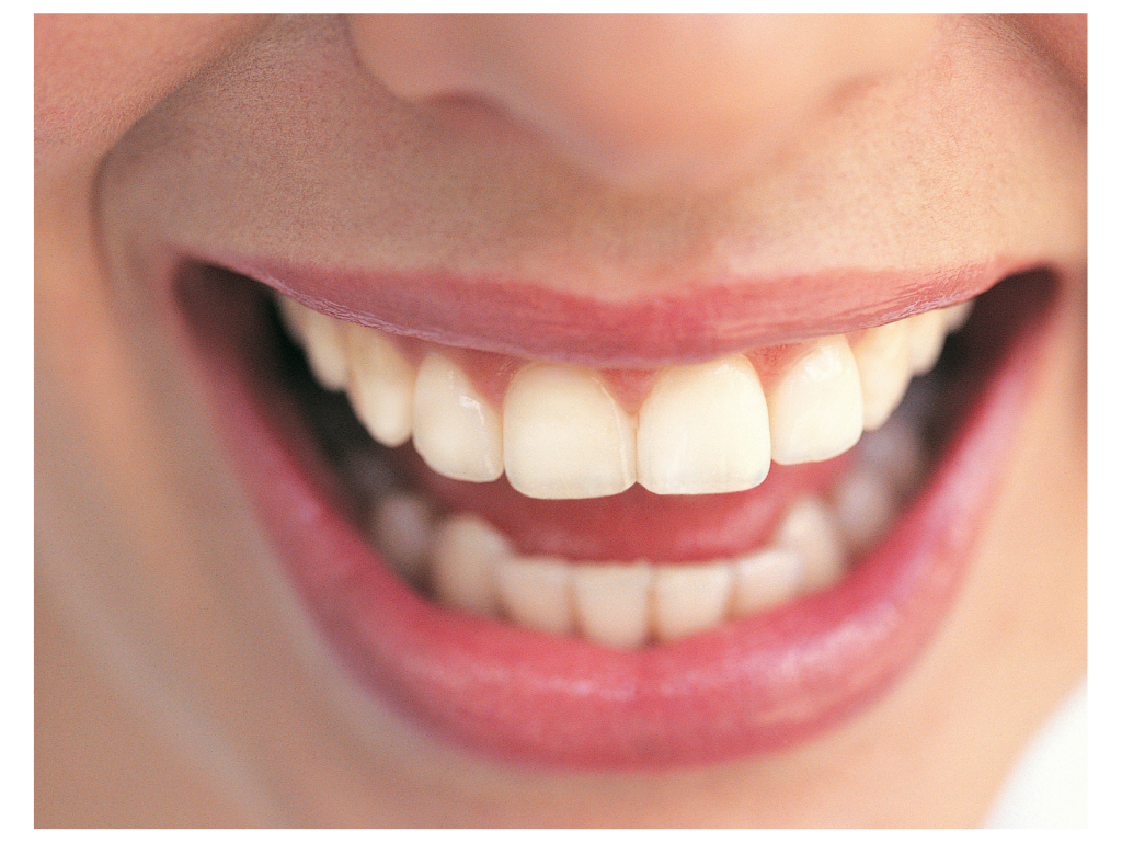 Professional Whitening Process and Oral B Toothbrush