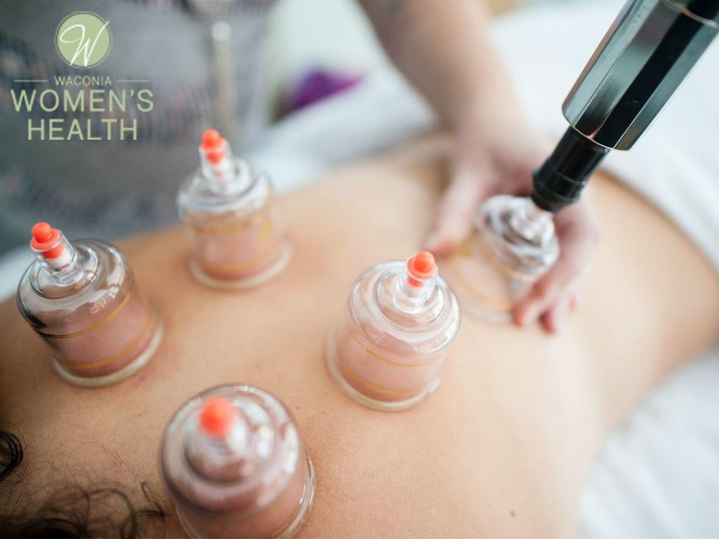 Cupping Therapy Session at Waconia Women