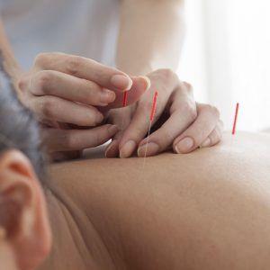 Initial Evaluation and Treatment- Acucare Acupunctur...