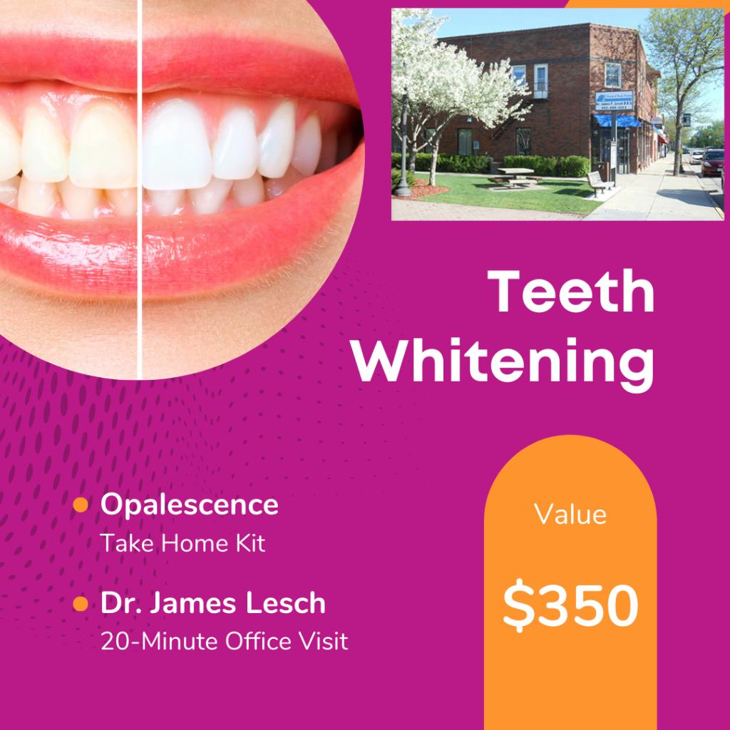 Opalescence Tooth Whitening System