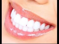 Professional At Home Whitening Treatment